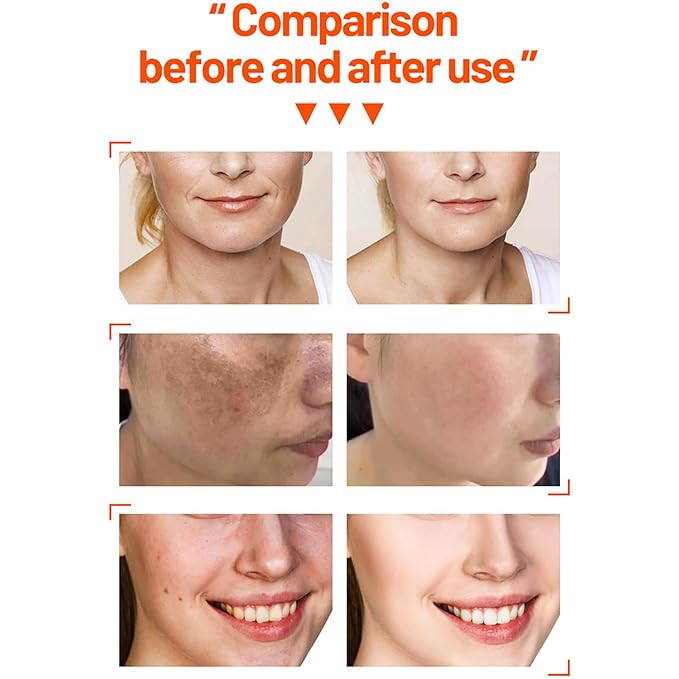 Vitamin C Organic Orange Extract Skin Care Set Facial Wash Toner Serum Face Cream Moisturizing Reduce Wrinkles Hydrate 30ml+30ml+10ml+15g 4PCS