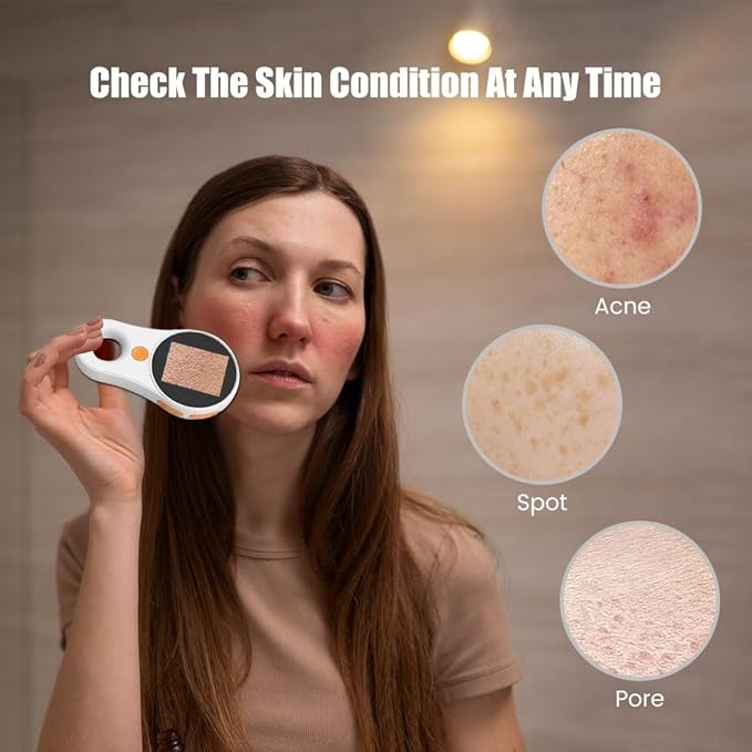 Handheld Dermatoscope Skin Analyzer Machine, Wireless Portable Digital Microscope with 1080P IPS Screen 8 LEDs, 500X Magnifier, for Scalp/Hair Trichomes Facial Skin Dermatoscope