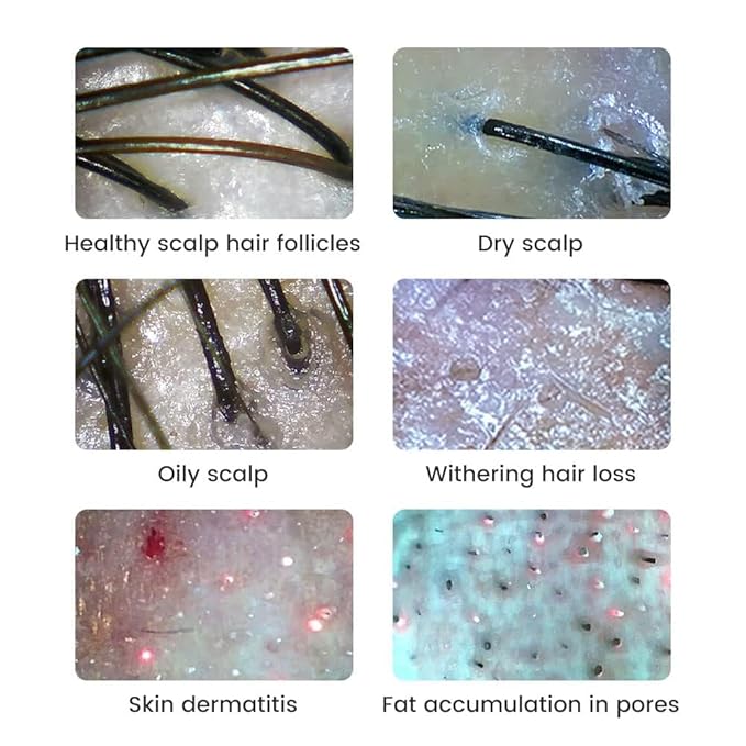 Handheld Dermatoscope Skin Analyzer Machine, Wireless Portable Digital Microscope with 1080P IPS Screen 8 LEDs, 500X Magnifier, for Scalp/Hair Trichomes Facial Skin Dermatoscope