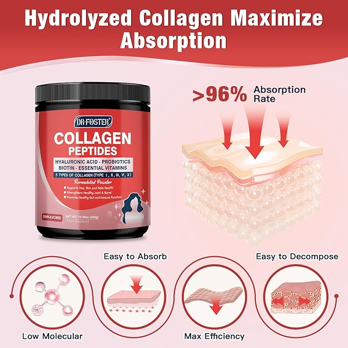 Collagen-Peptides-Powder with Probiotics - 5 Types of Hydrolyzed Collagen Peptides with Hyaluronic Acid, Biotin & Multivitamins - Skin, Hair, Joint & Gut Support - 35 Servings