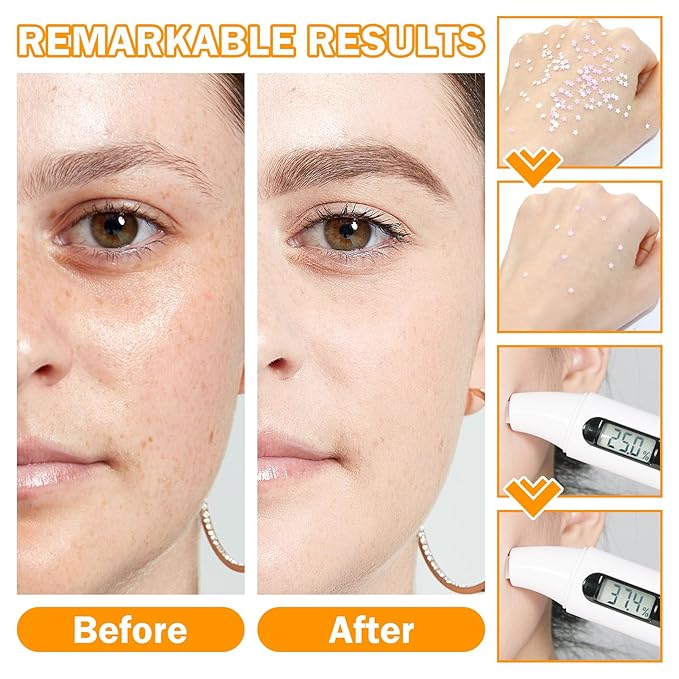 9 Pcs Travel Size Skin Care Set With Toner, Eye Cream, Facial Cleanser, Cream, Serum, Soap, Orange Masks, Hydrating Wash - Skincare Kit for All Skin Types