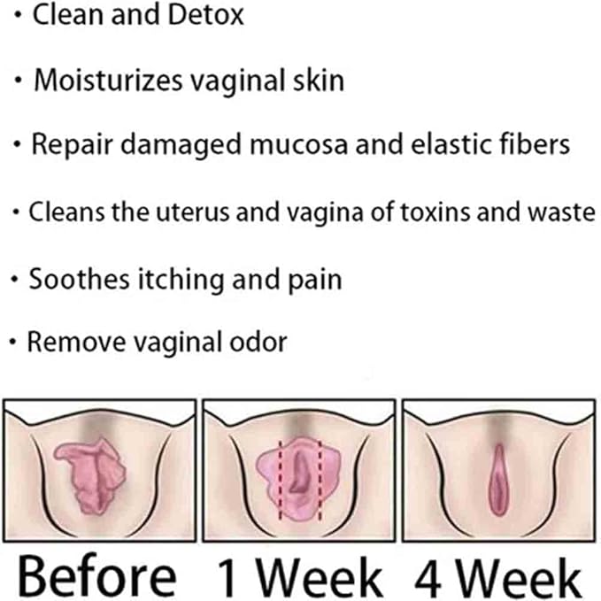 Instant Anti-Itch Detox Products, Capsulas, Firming Repair & Pink and Tender Natural Capsules, Capsulas (8Bag)