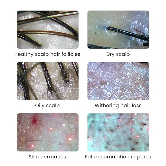 Handheld Dermatoscope Skin Analyzer Machine, Wireless Portable Digital Microscope with 1080P IPS Screen 8 LEDs, 500X Magnifier, for Scalp/Hair Trichomes Facial Skin Dermatoscope