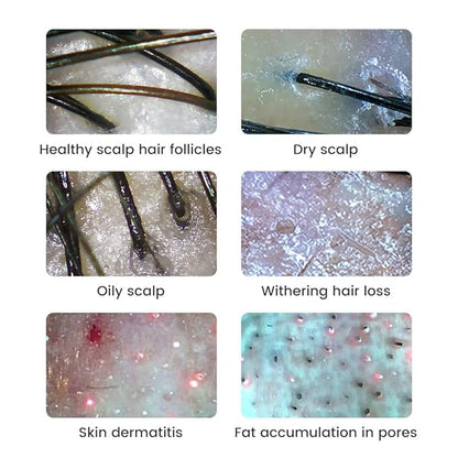 Handheld Dermatoscope Skin Analyzer Machine, Wireless Portable Digital Microscope with 1080P IPS Screen 8 LEDs, 500X Magnifier, for Scalp/Hair Trichomes Facial Skin Dermatoscope