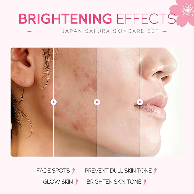 Skin Care Set for Women Girls, Cherry Blossoms Beauty Gift Sets Skin Care Kit with Cleanser, Face Serum, Face Cream,Toner,Eye Cream,Skin Care Routine Kit