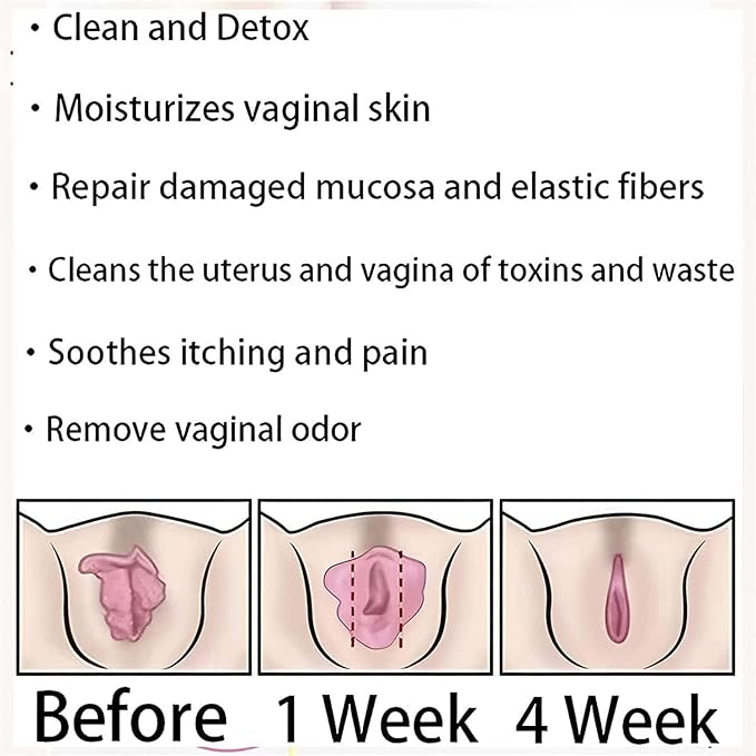 Annie Care Capsulas, Annie Care Capsulas, Pink and Tender Natural Capsules, Stay Clear & Fresh,Annie Care Capsulas 1