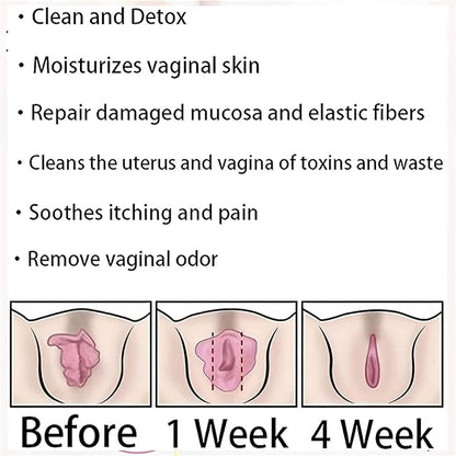 Annie Care Capsulas, Annie Care Capsulas, Pink and Tender Natural Capsules, Stay Clear & Fresh,Annie Care Capsulas 1