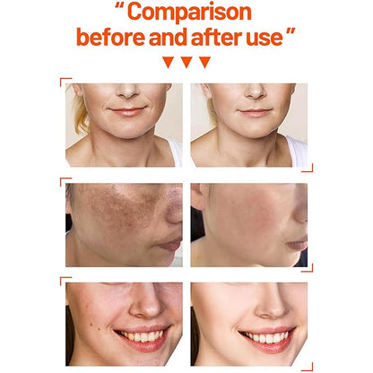 Vitamin C Organic Orange Extract Skin Care Set Facial Wash Toner Serum Face Cream Moisturizing Reduce Wrinkles Hydrate 30ml+30ml+10ml+15g 4PCS