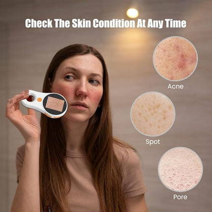 Handheld Dermatoscope Skin Analyzer Machine, Wireless Portable Digital Microscope with 1080P IPS Screen 8 LEDs, 500X Magnifier, for Scalp/Hair Trichomes Facial Skin Dermatoscope