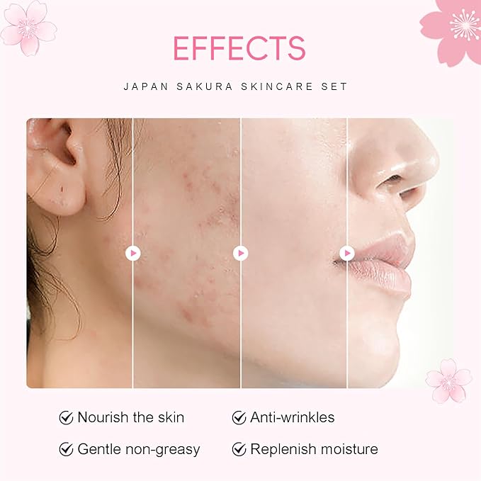 Sakura Skincare Set Facial Kit - Skin Care Gift Set for Girls/Women's, Facial Skin Care Sets & Kits with Beauty Gift Box, Japanese Skin Care Products Hydrating&Anti-Aging Skin - TSA-Friendly 8Pcs