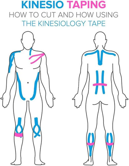 Kinesiology Tape<20 Precut Strips>Pro Elastic Athletic Tape,Cotton Waterproof Breathable Hypoallergenic Sport Tape for Joints Support & Muscle Pain Relief(Skin Color)