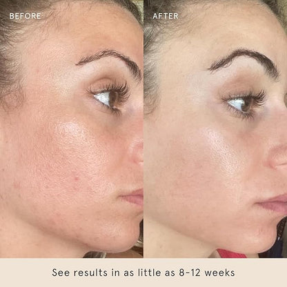 Barefaced Liquid Gold 30ml - 15% Vitamin C Serum with Hyaluronic Acid & Vitamin E for Brightening, Anti-Aging, and Hydration, Antioxidant Formula, Reduce Dark Spots, Acne & Wrinkles