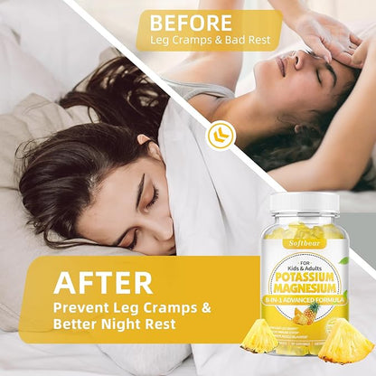 softbear Potassium Gummies for Adults, Sugar-Free Potassium Magnesium Supplement with Vitamin B6 CoQ10 for Leg Cramps Muscle Health Vegan Pineapple Flavor 60 Gummies