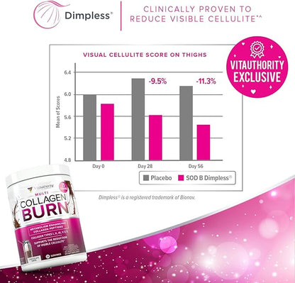 Vitauthority Collagen Peptides Powder Weight Loss | Collagen Supplements Hydrolyzed Beauty Complex | Multi Collagen for Women, Hair Skin Nails | Fat Burning Support | Chocolate Flavored 25 Servings