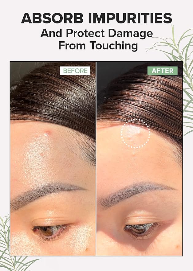 I DEW CARE Blemish Skincare Set - Ready Aim Clear | Face Mask & Acne Patch & Pimple Popper Tool, with Tea Tree Oil, Soothing & Hydrating, Treatment, Oily & Sensitive Skin
