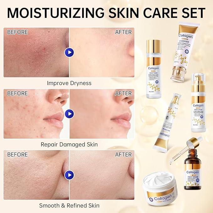 Collagen Skin Care Set, Anti Aging Skincare Set for Face, Shrink Pores, Hydrate & Firm Skin, 6 Pcs Individually Packaged Skincare Kits for Women with Cleanser, Toner, Lotion, Serum, Cream, Eye Cream.