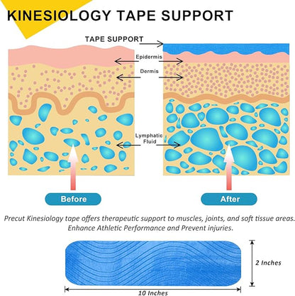 Kinesiology Tape Precut 2 Rolls Pack, Athletic Tape for Muscle Joints Support, 40 Strips for Knee Ankle Shoulder Back, Latex Free and Water Resistant, Dark Blue