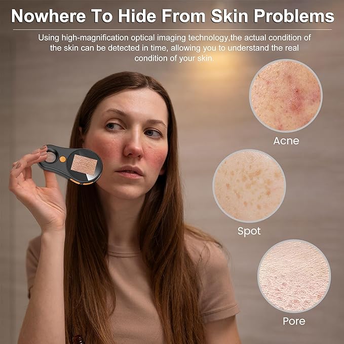 Handheld Dermatoscope Skin Analyzer Machine, Wireless Portable Digital Microscope with 1080P IPS Screen 8 LEDs, 500X Magnifier, for Scalp/Hair Trichomes Facial Skin Dermatoscope