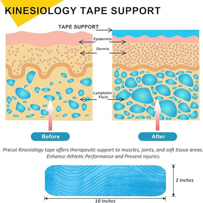 Kinesiology Tape Precut 2 Rolls Pack, Athletic Tape for Muscle Joints Support, 40 Strips for Knee Ankle Shoulder Back, Latex Free and Water Resistant, Blue