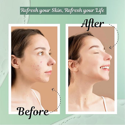 Kore Korean Skin Care Set–3-Piece Skincare Kit with Salicylic Acid Cleanser, Hydrating Toner & Daily Moisturizer–Vegan & PH Balancing Korean Skincare for Glass Skin–Skin Care Routine Kit for Women