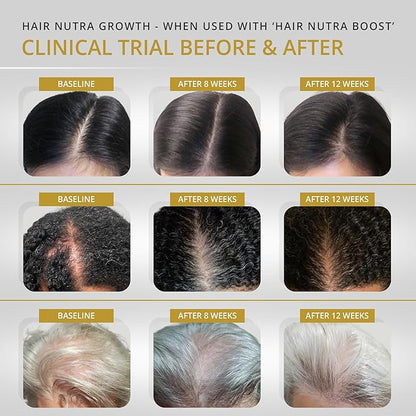 VITAMINS REVIVE Hair Supplement Hair Growth Vitamins for Women - USA Clinically Tested - Hair Loss Products for Thinning & Thickening - Female Hair Regrowth Treatment (1 Month Supply)
