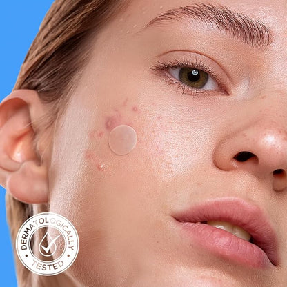 AVARELLE Pimple Patches for Face | Hydrocolloid Acne Patches for Covering Blemishes | FSA HSA Zit Patches with Tea Tree, Calendula, & Cica | HSA Store Eligible Items (10-14 mm, 80 Count)